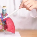 Pulmonologist